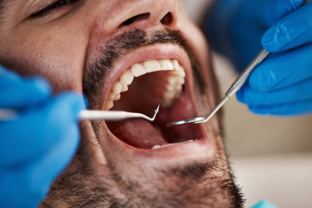 Best Emergency Care for Gum Disease in Woodbranch, TX